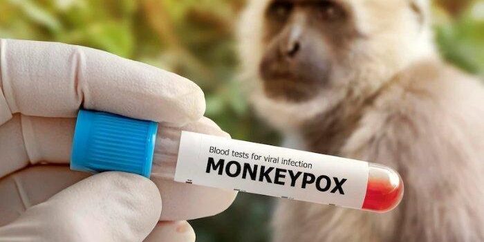 Kemenkes Catat 88 Kasus Mpox ‘Cacar Monyet’, Ini Varian yang Merebak di RI